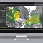 Renishaw neuro solutions selects CodeSonar static analysis for neurosurgical robot