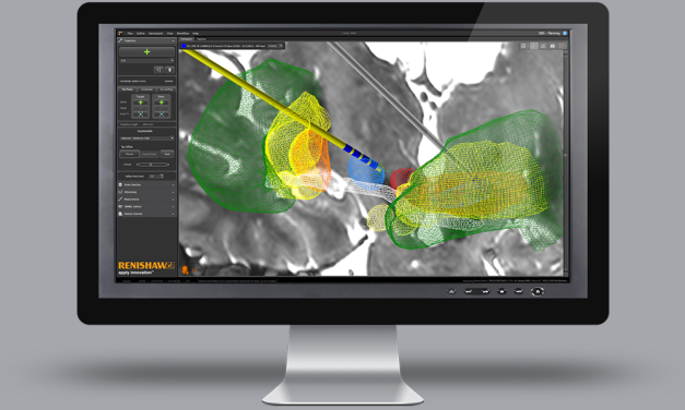 Renishaw neuro solutions selects CodeSonar static analysis for neurosurgical robot